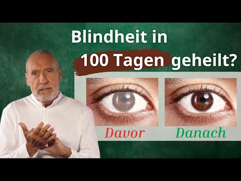 Augentraining funktioniert! Erfahrung von Karl Gamper